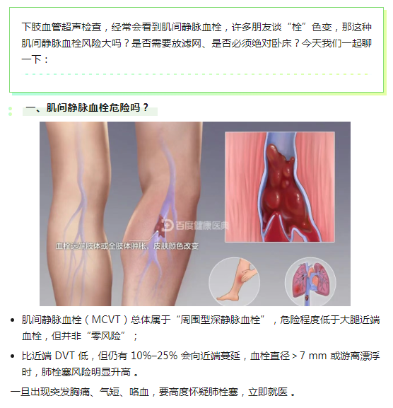 肌间静脉血栓危险吗？需不需要放滤网？要绝对卧床休息吗